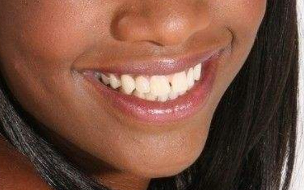 2023年河南哪家醫(yī)院手術(shù)消除動態(tài)細(xì)紋效果更佳？全新美容醫(yī)院排行榜曝光！