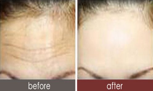 長沙專業(yè)祛痘整形醫(yī)院推薦，最具實力的醫(yī)院盤點