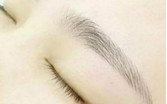 樂(lè)山市人民醫(yī)院中瞇眼袋手術(shù)談何效果？眼袋修復(fù)專(zhuān)家醫(yī)師及成功案例分享