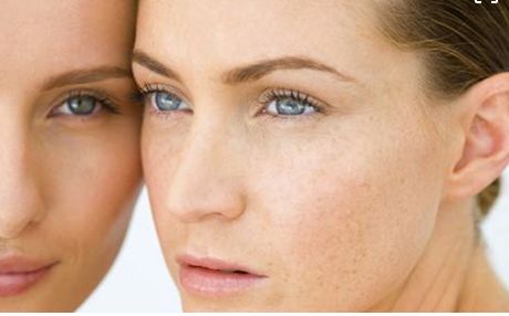 成都當(dāng)?shù)孛廊菡吾t(yī)院鼻部整形效果如何？真實案例發(fā)布！