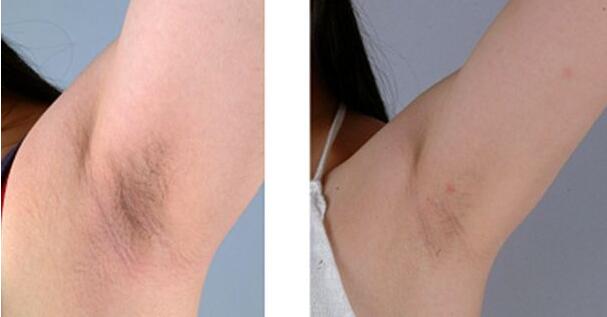 2023長(zhǎng)春市中心醫(yī)院整形外科價(jià)格如何？【宋彬】醫(yī)生經(jīng)驗(yàn)分享真可信嗎？