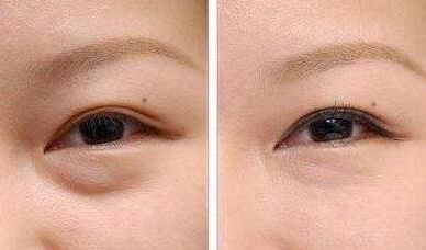 上海九院種植牙醫(yī)生推薦：這幾位牙醫(yī)技術(shù)獨特，深受患者好評！