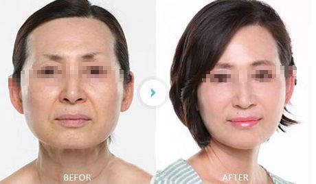 南寧整形醫(yī)院排行榜大揭秘，找準(zhǔn)專業(yè)的整形醫(yī)院才能保證安全與效果