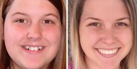 安琪兒醫(yī)療婦產(chǎn)醫(yī)院醫(yī)療美容科真實(shí)價(jià)格分享及醫(yī)生口碑測(cè)評(píng)