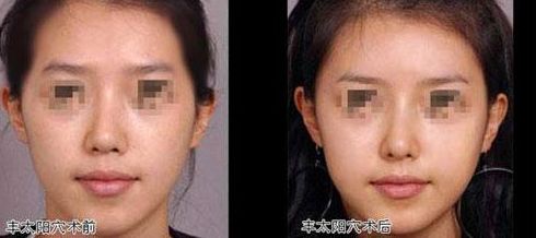 北京比較好的乳房再造醫(yī)院推薦