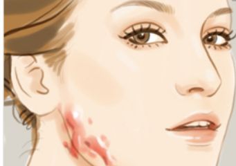 北京哪家醫(yī)院可以洗紋身呢？