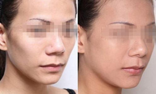 寧波權威眼科醫(yī)院匯總：地址、專家一覽表