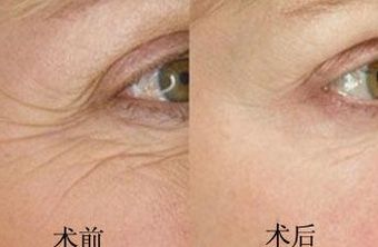 南京鳳凰島整形外科門診部的王科醫(yī)生口碑如何？聯(lián)合李敏醫(yī)生介紹及手術(shù)后的反饋，揭秘這位醫(yī)生的實力！