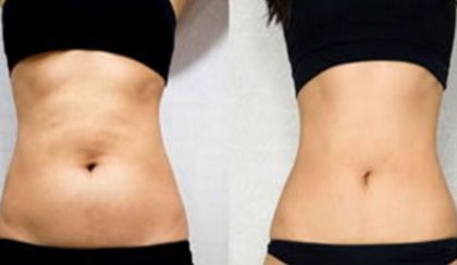 西安有哪些技術(shù)高超的雙眼皮修復(fù)醫(yī)生值得選擇？