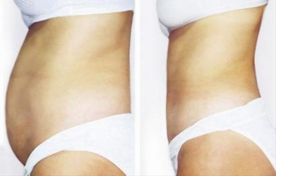 解決眼袋問(wèn)題的四川整形醫(yī)院推薦