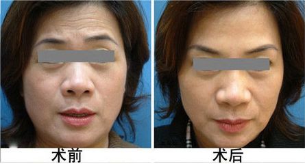 廣安阿藍(lán)醫(yī)院整形科評(píng)價(jià)，是否正規(guī)？地址詳細(xì)一覽