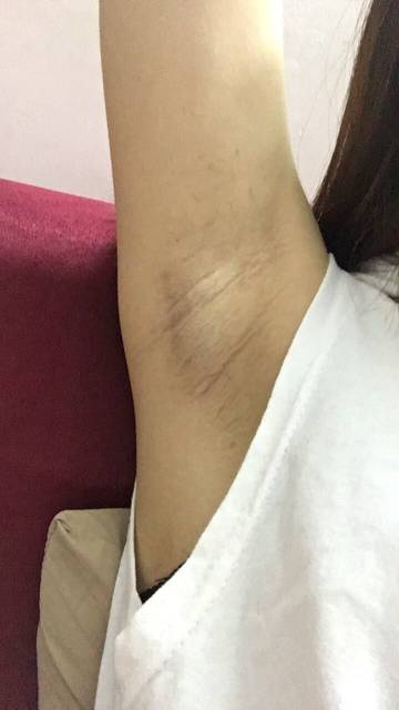 上海健橋植發(fā)技術(shù)實(shí)力如何？頭發(fā)再生效果值得期待嗎？