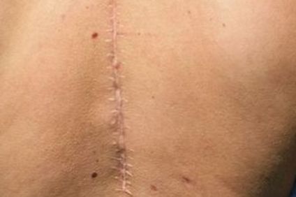 廣州龍城區(qū)手術(shù)神醫(yī)排行榜，醫(yī)術(shù)高超的拉皮專家一覽