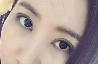 上海華東醫(yī)院整形外科主任醫(yī)師榜單揭曉！先進(jìn)隆鼻療法案例分享及費(fèi)用明細(xì)，急需閱讀！