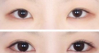 廣州韓后許滿萍醫(yī)生的專業(yè)領(lǐng)域揭秘，令人驚喜的嫩膚案例分享