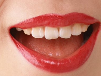 北京301醫(yī)院雷永紅如何進(jìn)行雙眼皮手術(shù)？真實(shí)案例分享