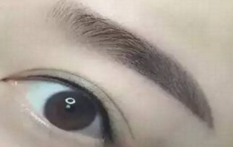 哈爾濱醫(yī)科大學(xué)二院最新整形去痦子技術(shù)揭秘，讓肌膚恢復(fù)純凈光潔