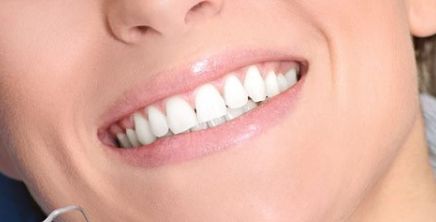 西京醫(yī)院鼻部整形丨馬顯杰教授，項(xiàng)目介紹與真人案例圖解析