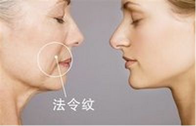 美麗改變，趙德星鼻子整形前后對比，驚艷有度！