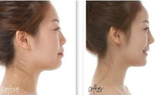 廣州植發(fā)全新醫(yī)院排行榜，權(quán)威榜單公布，趕緊收藏！