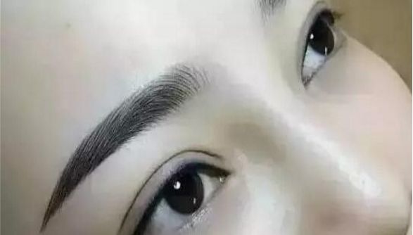 重慶曹陽的鼻子整形效果如何？醫(yī)生手藝獨(dú)步天下的真實(shí)案例分享