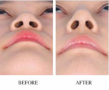 2023東莞非手術(shù)除皺塑形醫(yī)療美容醫(yī)院推薦，評分前10強震撼揭曉！