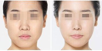 深圳整形美容醫(yī)院排名前十，哪家更受用戶好評(píng)？