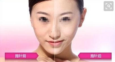 國內整形醫(yī)院排行榜TOP10