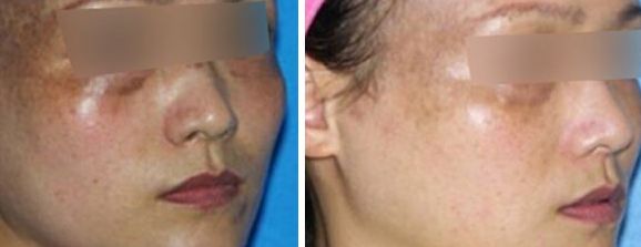 蘭州固定輪廓挑選攻略，幫你找到最佳選擇！