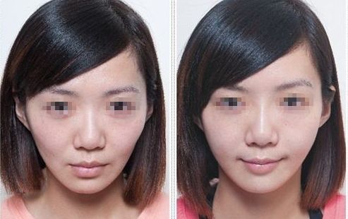 大連大學(xué)附屬新華醫(yī)院整形外科：2023年度公開(kāi)回顧