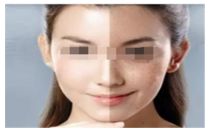 2024年鄭州地區(qū)比較權(quán)威的整形醫(yī)院三甲名單盤點(diǎn)