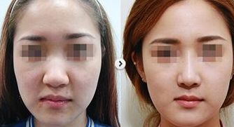 找尋比較好的整形醫(yī)院？依托專業(yè)實(shí)力，佛山聚焦多家令人信賴醫(yī)院，就等您選擇！