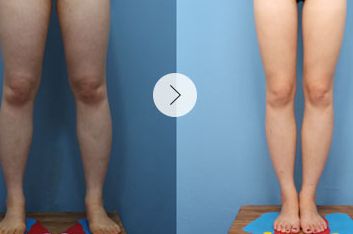 上海整容醫(yī)院排行：領(lǐng)先全球的磨骨技術(shù)，醫(yī)院評分驚人！