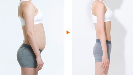 陳振宇的雙眼皮手術(shù)效果如何？在青醫(yī)附院的真實案例鑒賞提供參考