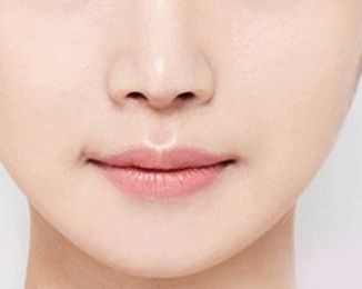 空軍總醫(yī)院眼袋手術(shù)費用及技術(shù)解析，醫(yī)師解讀+成功案例分享