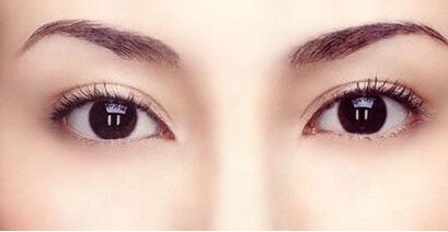 霍玉旺：中國鼻型塑造的頂尖大師！真實案例揭秘！