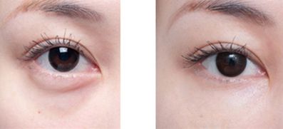 沈陽整形醫(yī)院精心挑選，排名領(lǐng)先醫(yī)院揭曉