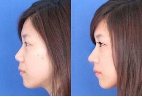 上海整形醫(yī)院排行榜前三資深專家力薦！整容技術(shù)卓越，名副其實！