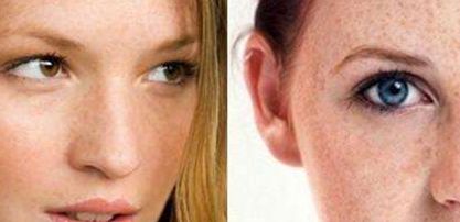 黃久佐醫(yī)生為你分享雙眼皮效果及技術(shù)測(cè)評(píng)！