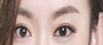 貴陽(yáng)美貝爾徐威鼻子整形效果如何？90天親身經(jīng)歷曝光案例揭秘