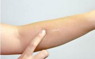 上海脂肪抽吸醫(yī)生技術(shù)大比拼，排行前十新榜單揭曉