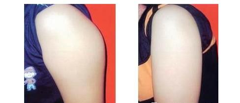 上海九院的整形價格表是怎樣的？它適合想要變美的人嗎？