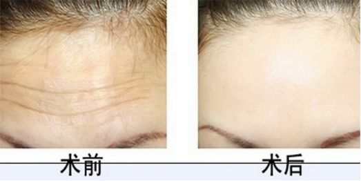 北京協(xié)和整形科的醫(yī)術(shù)高超，專家團(tuán)隊(duì)實(shí)力強(qiáng)大，您值得信賴