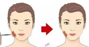 深圳整形圈熱門推薦！七位口碑高的假體豐臀醫(yī)生信息來襲！