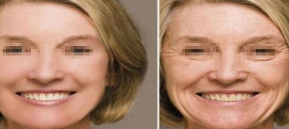 大連許英醫(yī)療美容如何？找到適合你的完美美容之處