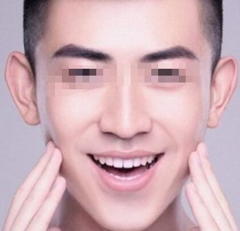 北京治疤痕手術哪家醫(yī)院好？