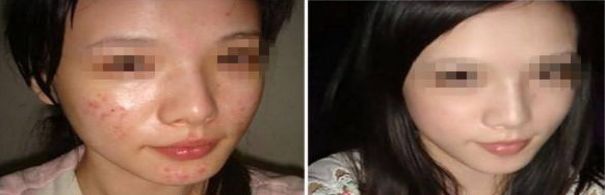 成都整形美容醫(yī)院排名揭曉，領(lǐng)先競(jìng)爭(zhēng)對(duì)手遠(yuǎn)遠(yuǎn)搶先！