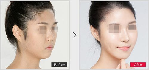 蘭州那家醫(yī)院能治療磨骨比較好？