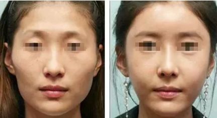 廣州有哪些知名整形醫(yī)院？