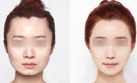 昆明哪里有最好的眼部手術(shù)整形醫(yī)院？2024年10家排名搶先曝光！